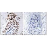 Immunohistochemistry - DAPK3 (Ab-265) Antibody from Signalway Antibody (33158) - Antibodies.com