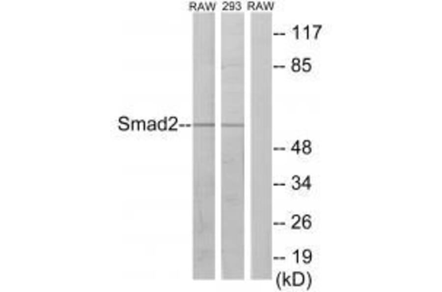 Western blot - Smad2 (Ab-220) Antibody from Signalway Antibody (33164) - Antibodies.com