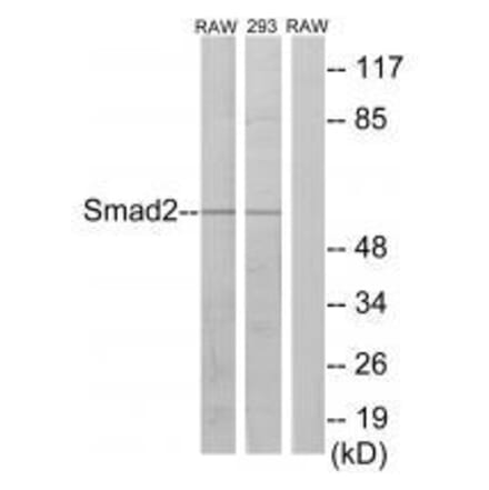 Western blot - Smad2 (Ab-220) Antibody from Signalway Antibody (33164) - Antibodies.com