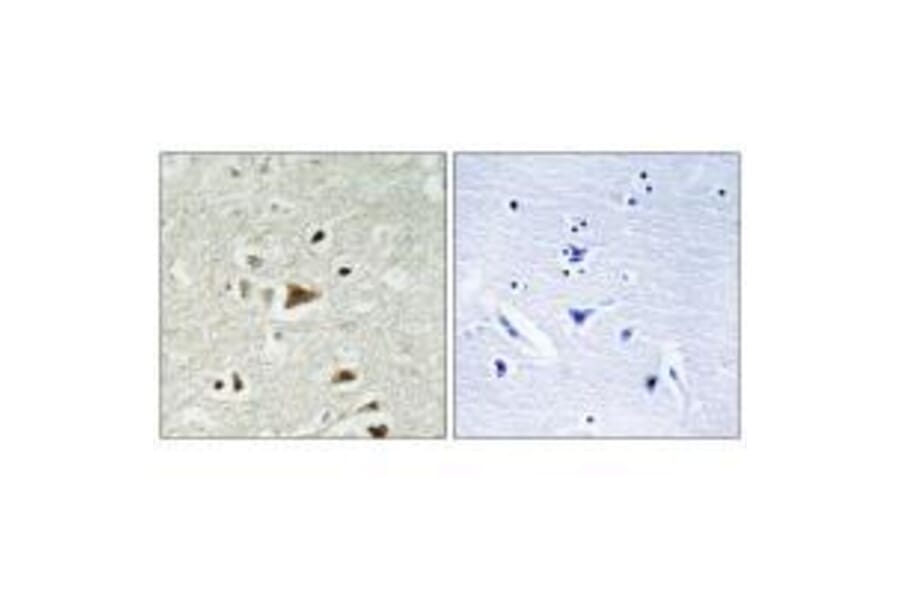 Immunohistochemistry - Smad2 (Ab-220) Antibody from Signalway Antibody (33164) - Antibodies.com