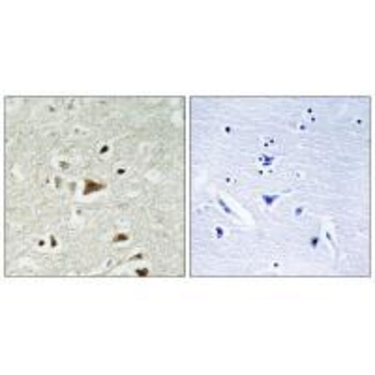 Immunohistochemistry - Smad2 (Ab-220) Antibody from Signalway Antibody (33164) - Antibodies.com
