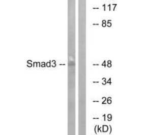 Western blot - Smad3 (Ab-204) Antibody from Signalway Antibody (33165) - Antibodies.com