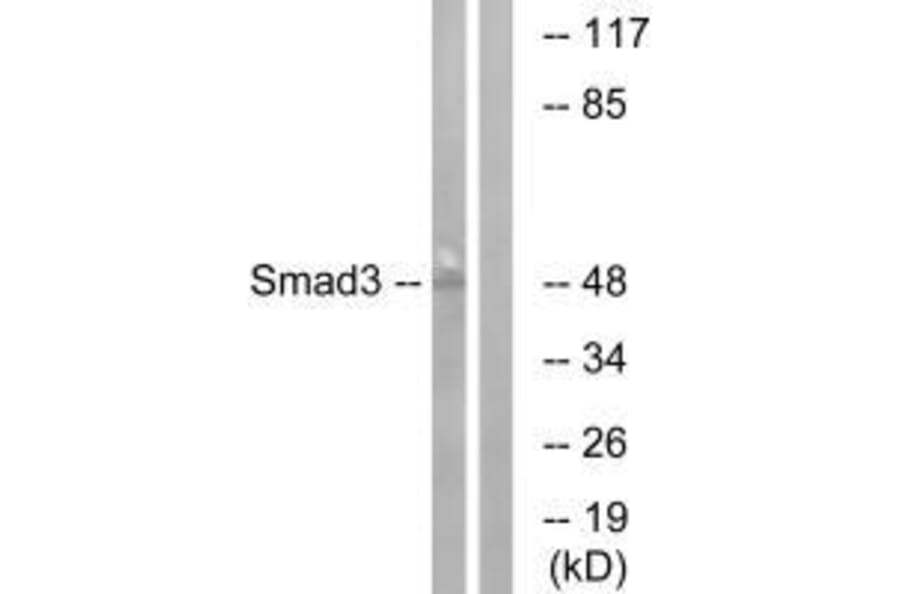 Western blot - Smad3 (Ab-204) Antibody from Signalway Antibody (33165) - Antibodies.com