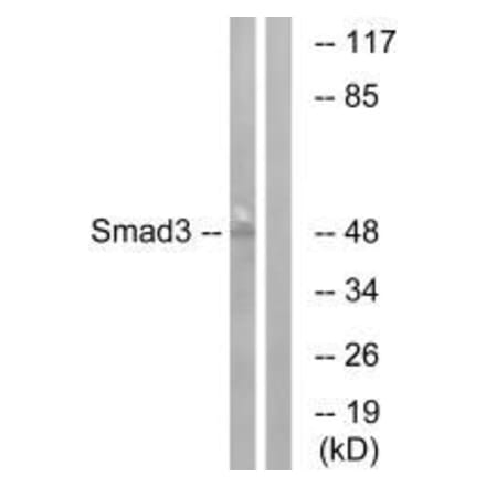 Western blot - Smad3 (Ab-204) Antibody from Signalway Antibody (33165) - Antibodies.com