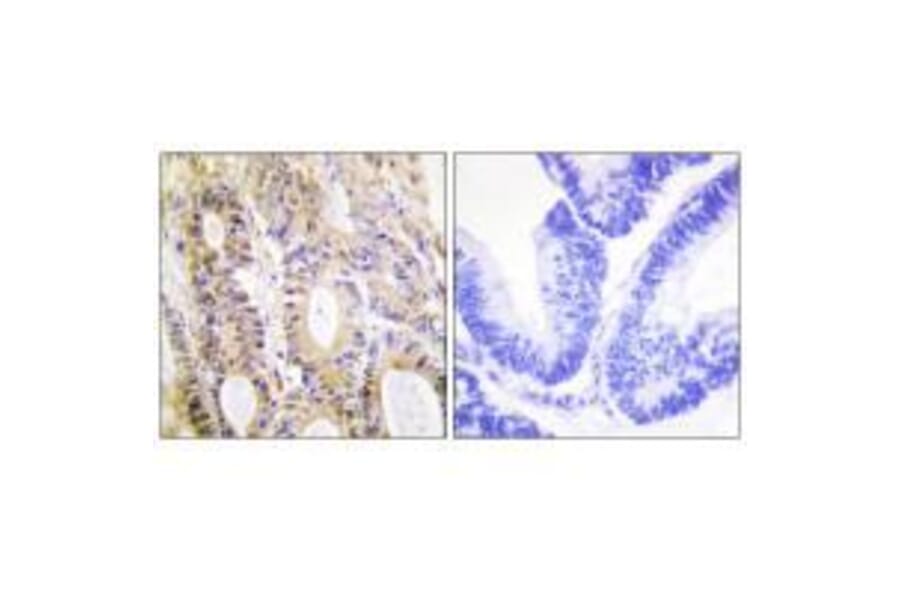 Immunohistochemistry - Smad3 (Ab-204) Antibody from Signalway Antibody (33165) - Antibodies.com