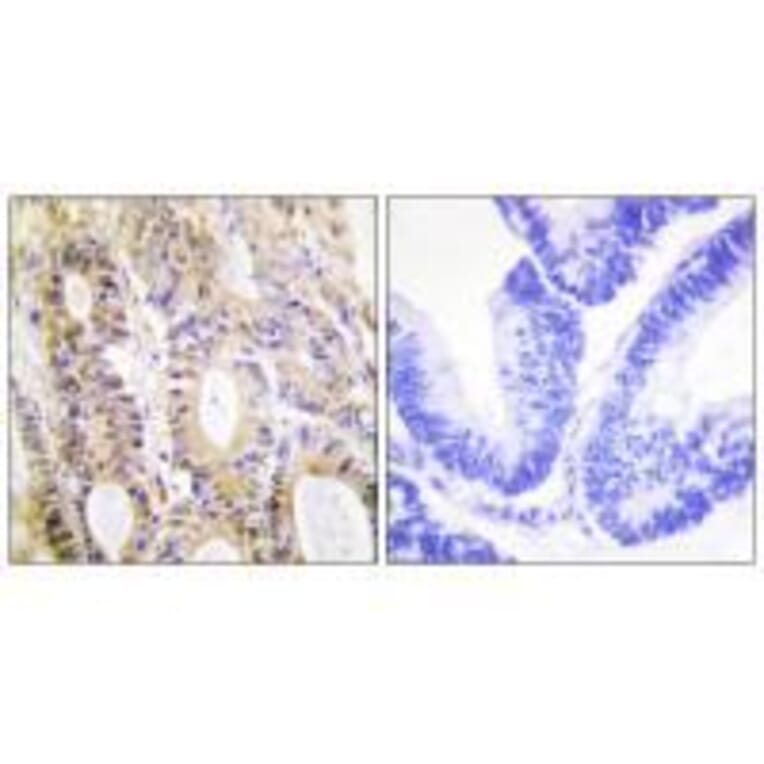 Immunohistochemistry - Smad3 (Ab-204) Antibody from Signalway Antibody (33165) - Antibodies.com