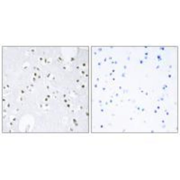 Immunohistochemistry - c-Jun (Ab-243) Antibody from Signalway Antibody (33194) - Antibodies.com