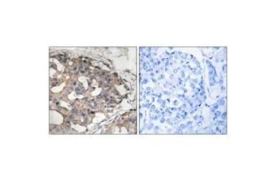 Immunohistochemistry - B-RAF (Ab-446) Antibody from Signalway Antibody (33226) - Antibodies.com