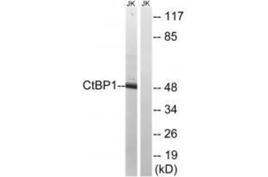 Western blot - CtBP1 (Ab-422) Antibody from Signalway Antibody (33281) - Antibodies.com