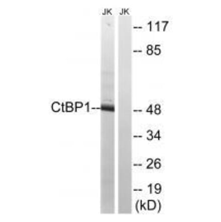 Western blot - CtBP1 (Ab-422) Antibody from Signalway Antibody (33281) - Antibodies.com