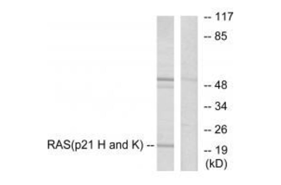 Western blot - RASH/RASK/RASN Antibody from Signalway Antibody (33478) - Antibodies.com