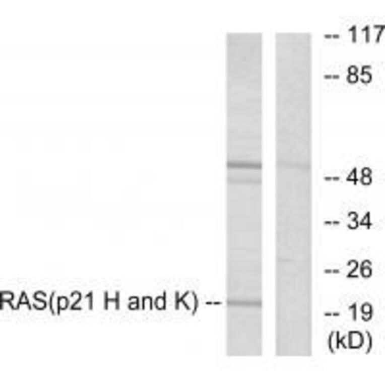 Western blot - RASH/RASK/RASN Antibody from Signalway Antibody (33478) - Antibodies.com