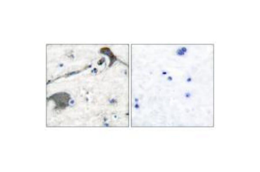 Immunohistochemistry - RASH/RASK/RASN Antibody from Signalway Antibody (33478) - Antibodies.com