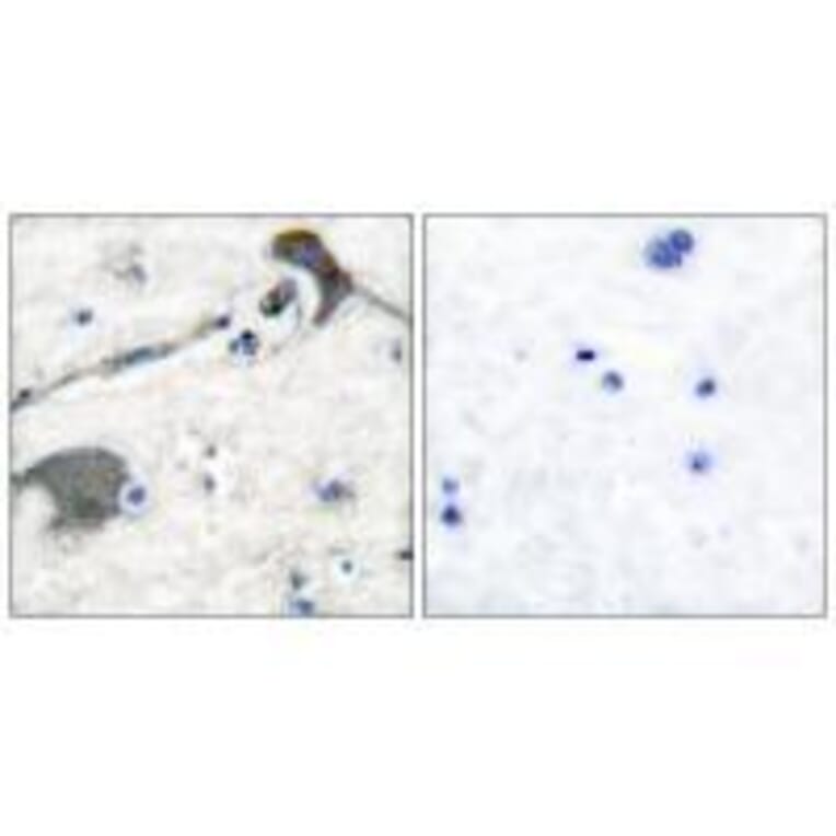 Immunohistochemistry - RASH/RASK/RASN Antibody from Signalway Antibody (33478) - Antibodies.com