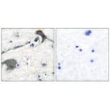 Immunohistochemistry - RASH/RASK/RASN Antibody from Signalway Antibody (33478) - Antibodies.com