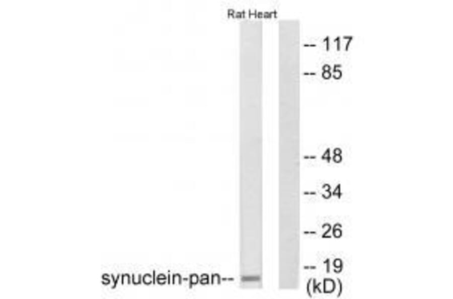 Western blot - Synuclein-pan Antibody from Signalway Antibody (33495) - Antibodies.com