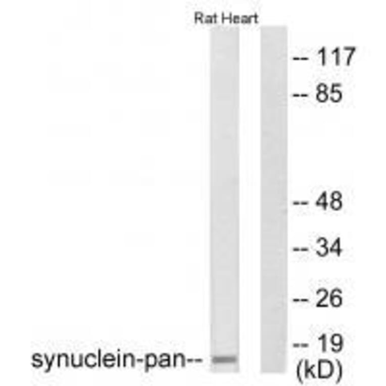 Western blot - Synuclein-pan Antibody from Signalway Antibody (33495) - Antibodies.com