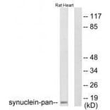 Western blot - Synuclein-pan Antibody from Signalway Antibody (33495) - Antibodies.com