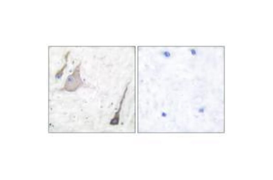 Immunohistochemistry - Synuclein-pan Antibody from Signalway Antibody (33495) - Antibodies.com