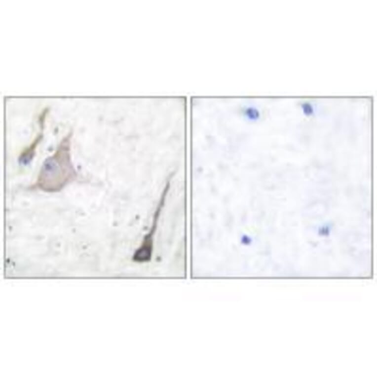 Immunohistochemistry - Synuclein-pan Antibody from Signalway Antibody (33495) - Antibodies.com