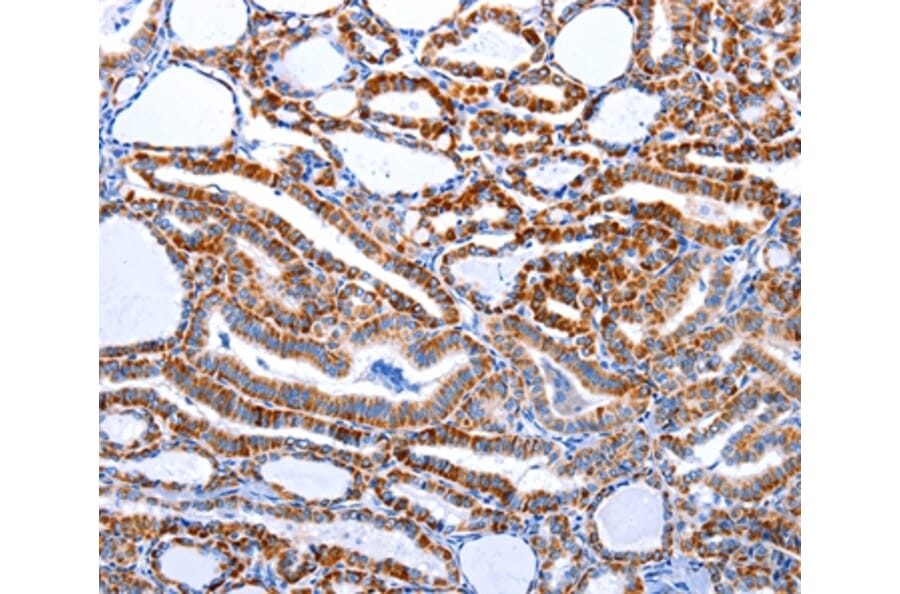 Immunohistochemistry - CASP3 (active) Antibody from Signalway Antibody (36719) - Antibodies.com