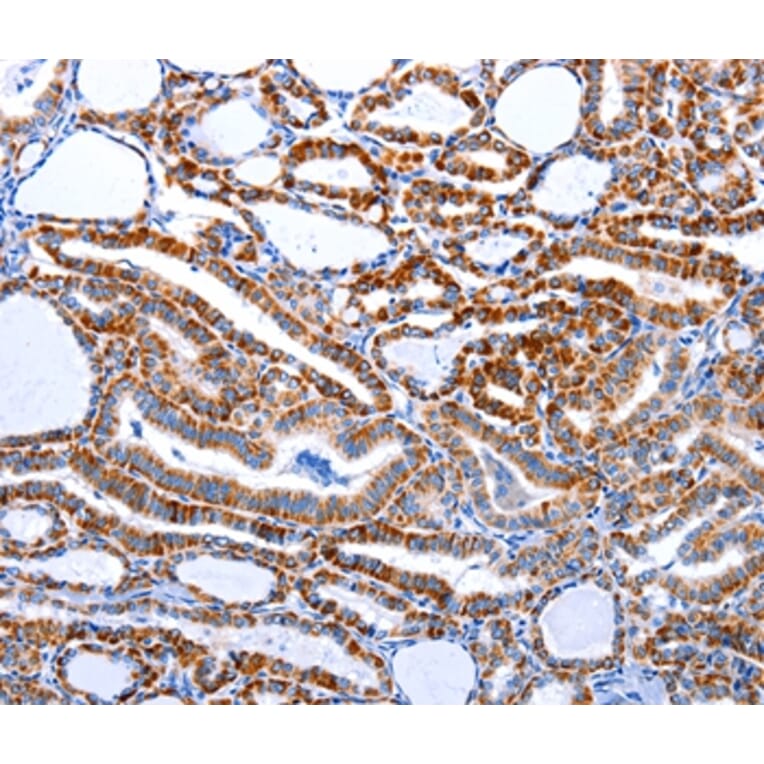 Immunohistochemistry - CASP3 (active) Antibody from Signalway Antibody (36719) - Antibodies.com