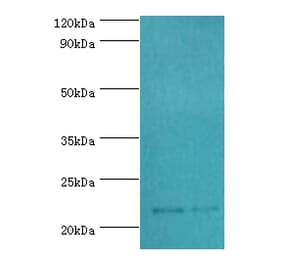 SRI Polyclonal Antibody from Signalway Antibody (42331) - Antibodies.com