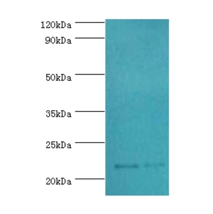 SRI Polyclonal Antibody from Signalway Antibody (42331) - Antibodies.com