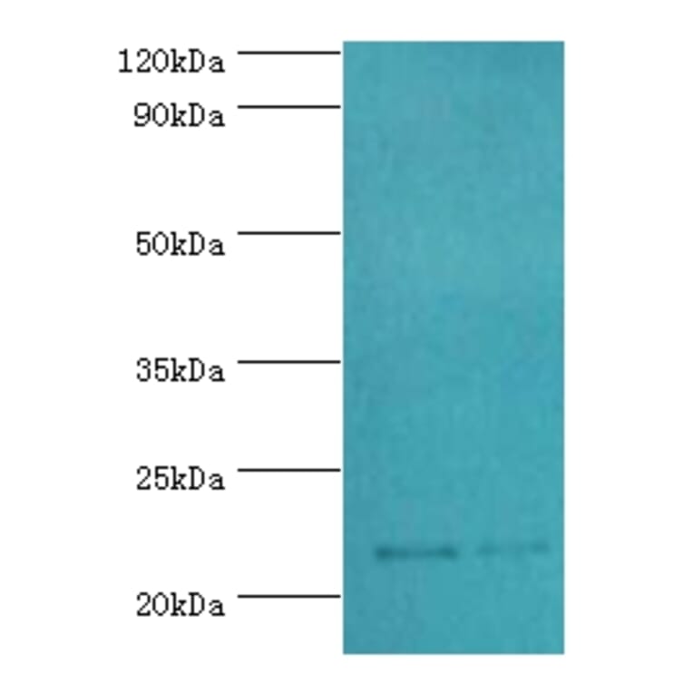 SRI Polyclonal Antibody from Signalway Antibody (42331) - Antibodies.com