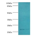 SRI Polyclonal Antibody from Signalway Antibody (42331) - Antibodies.com