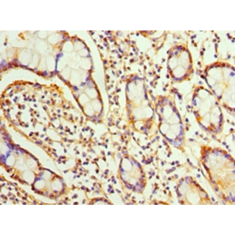 Immunohistochemistry - SRI Polyclonal Antibody from Signalway Antibody (42331) - Antibodies.com