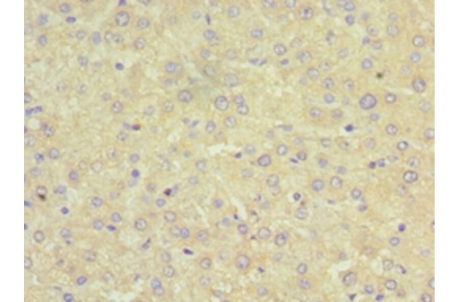 Immunohistochemistry - SRI Polyclonal Antibody from Signalway Antibody (42331) - Antibodies.com