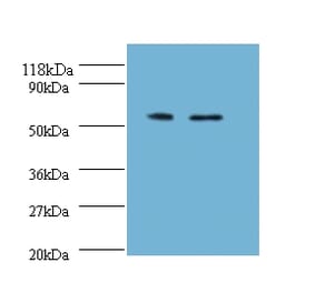 Citrate synthase, mitochondrial Polyclonal Antibody from Signalway Antibody (42137) - Antibodies.com