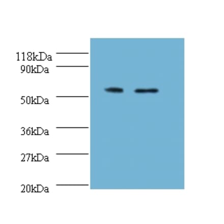 Citrate synthase, mitochondrial Polyclonal Antibody from Signalway Antibody (42137) - Antibodies.com