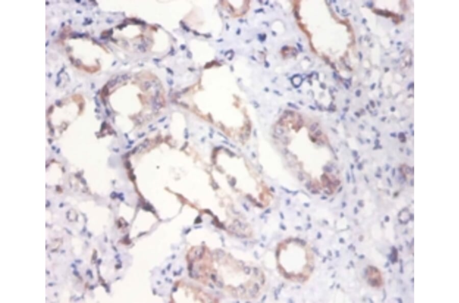 Immunohistochemistry - Citrate synthase, mitochondrial Polyclonal Antibody from Signalway Antibody (42137)