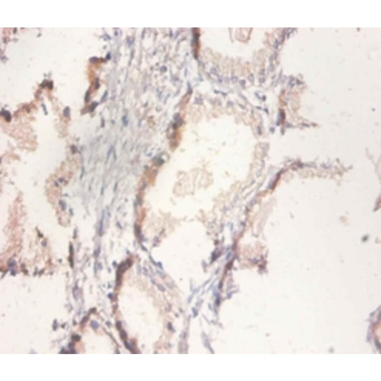 Immunohistochemistry - Citrate synthase, mitochondrial Polyclonal Antibody from Signalway Antibody (42137)