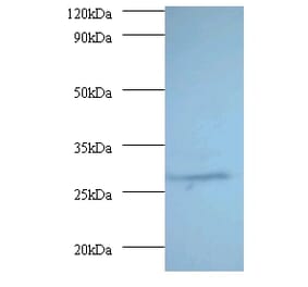 Proteasome subunit alpha type-7 Polyclonal Antibody from Signalway Antibody (42246) - Antibodies.com