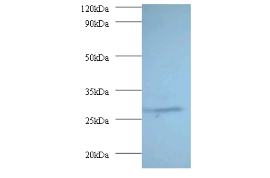 Proteasome subunit alpha type-7 Polyclonal Antibody from Signalway Antibody (42246) - Antibodies.com
