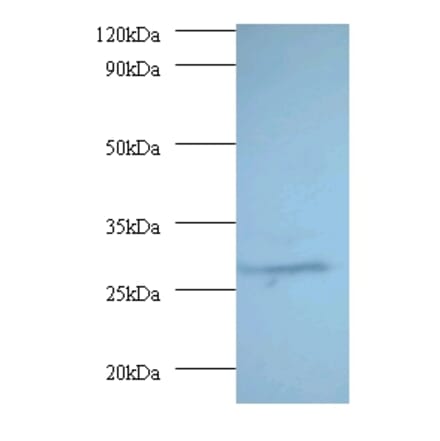 Proteasome subunit alpha type-7 Polyclonal Antibody from Signalway Antibody (42246) - Antibodies.com