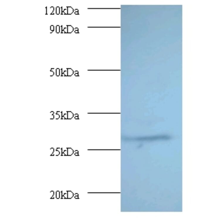 Proteasome subunit alpha type-7 Polyclonal Antibody from Signalway Antibody (42246) - Antibodies.com