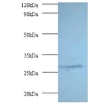 Proteasome subunit alpha type-7 Polyclonal Antibody from Signalway Antibody (42246) - Antibodies.com