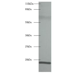 60S acidic ribosomal protein P1 Polyclonal Antibody from Signalway Antibody (42345) - Antibodies.com