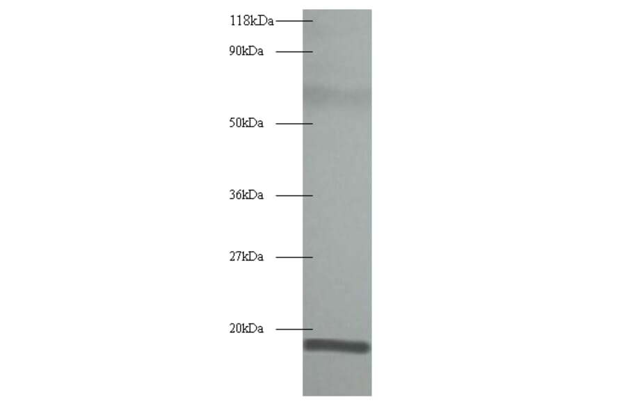 60S acidic ribosomal protein P1 Polyclonal Antibody from Signalway Antibody (42345) - Antibodies.com