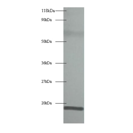 60S acidic ribosomal protein P1 Polyclonal Antibody from Signalway Antibody (42345) - Antibodies.com