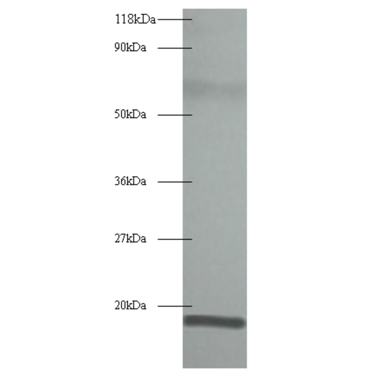 60S acidic ribosomal protein P1 Polyclonal Antibody from Signalway Antibody (42345) - Antibodies.com