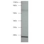 60S acidic ribosomal protein P1 Polyclonal Antibody from Signalway Antibody (42345) - Antibodies.com
