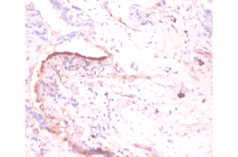 Immunohistochemistry - 60S acidic ribosomal protein P1 Polyclonal Antibody from Signalway Antibody (42345)