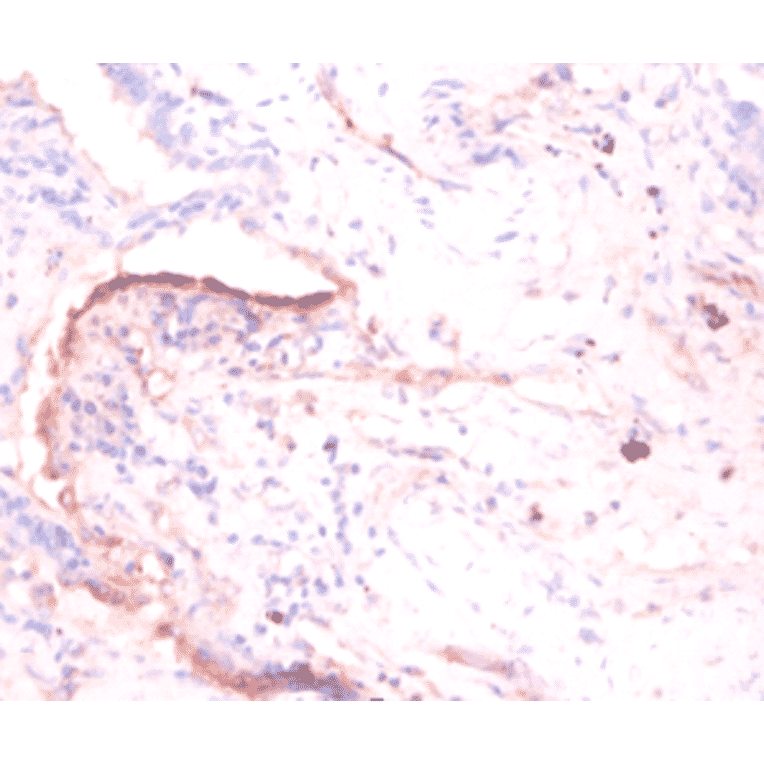 Immunohistochemistry - 60S acidic ribosomal protein P1 Polyclonal Antibody from Signalway Antibody (42345)