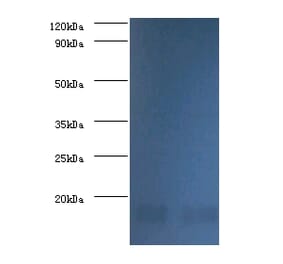 Nucleoside diphosphate kinase A Polyclonal Antibody from Signalway Antibody (42376) - Antibodies.com