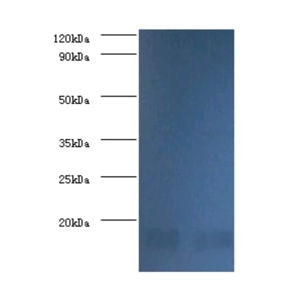Nucleoside diphosphate kinase A Polyclonal Antibody from Signalway Antibody (42376) - Antibodies.com